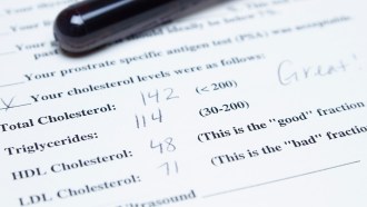 A vial of blood sit on top of piece of paper with the results of a cholesterol test.