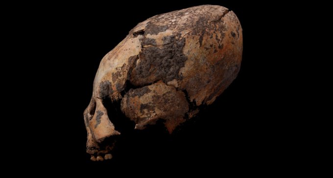 elongated skull from China