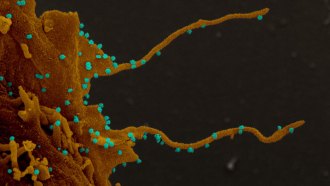 Coronavirus-infected cell with filopodia