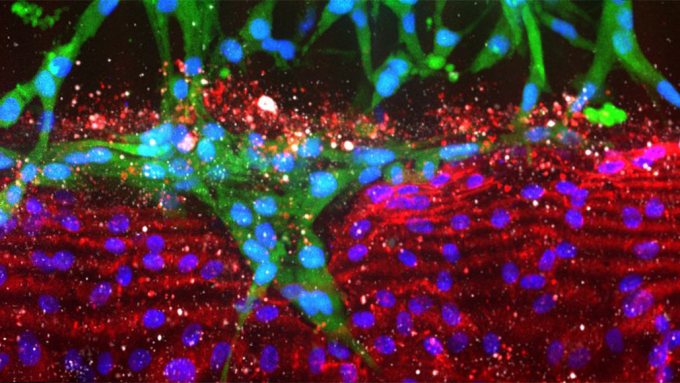 pancreatic cancer cells