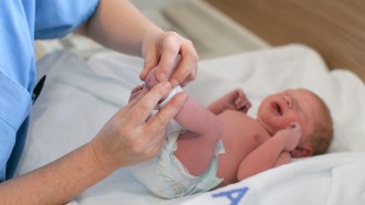 A pediatrician administers a heel prick test to check sucrose levels in a newborn baby boy after a caesarean section.