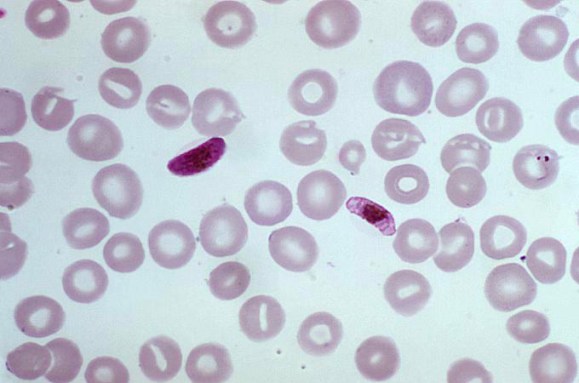 Plasmodium falciparum