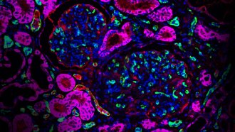 microscope image showing pig kidney tissue with human proteins in fuchsia