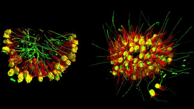 choanoflagellates