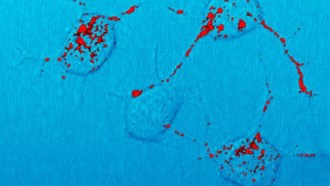 prion proteins