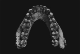 Oldest jaw