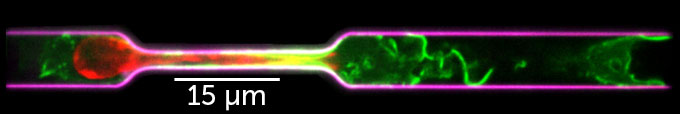 A mouse immune cell contorts its cytoskeleton and nucleus as it squeezes through a microchannel with a narrow constriction.